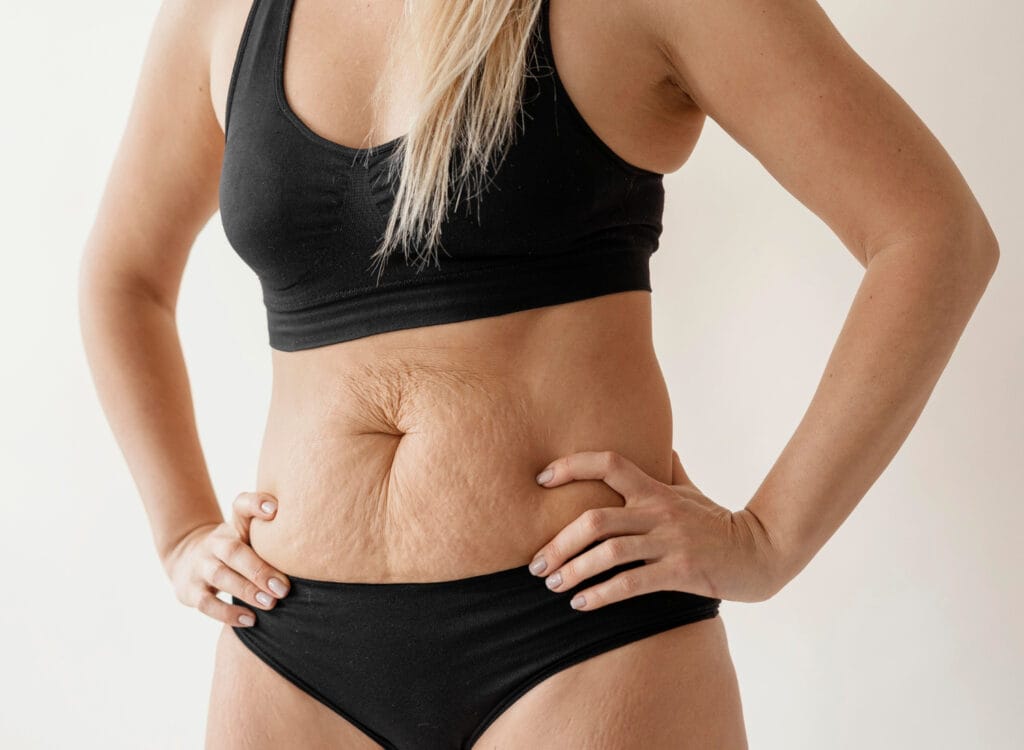 Helping our Patients in Plainfield reach their weight loss goals