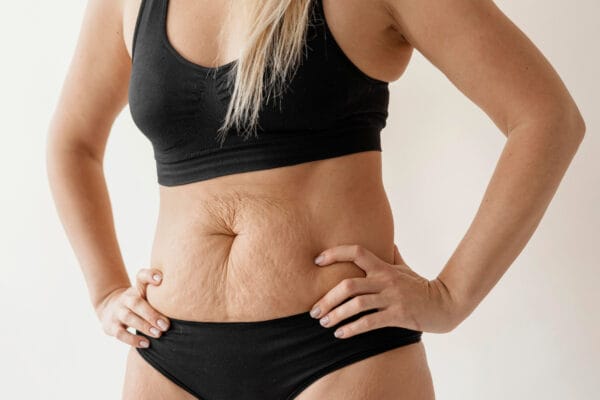 Helping our Patients in Plainfield reach their weight loss goals
